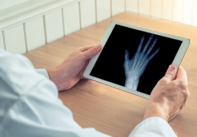 Veteran viewing an X-ray on tablet
